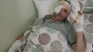 Грав з Мілевським і Алієвим, а зараз отримав поранення на фронті: вихованець Динамо у важкому стані