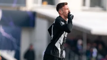 Наслідки стику в грі Полісся – Динамо: житомиряни опублікували фото ноги Емерллаху після удару Біловара