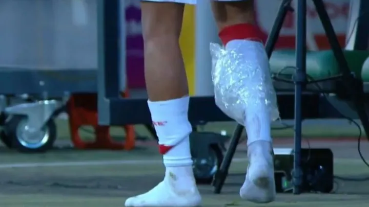 Жорсткий фол у матчі УПЛ: стала відома попередня оцінка травми лідера Кривбаса