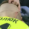 «‎Укус комара»: тренер Колосу відреагував на розбиту голову свого воротаря у матчі з Динамо