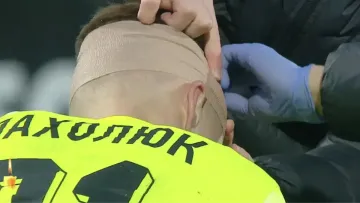 «‎Укус комара»: тренер Колосу відреагував на розбиту голову свого воротаря у матчі з Динамо