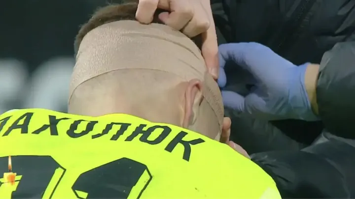 «‎Укус комара»: тренер Колосу відреагував на розбиту голову свого воротаря у матчі з Динамо